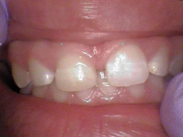 Before