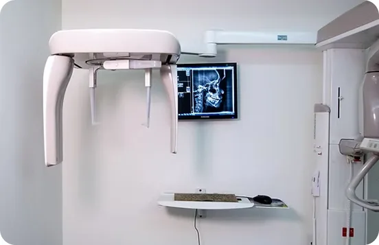 Digital X-Rays